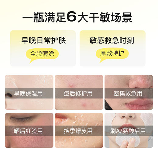 比度克换季速安修护乳霜30ml 速褪红热敏    28天修护油痘肌    维稳屏障 商品图3