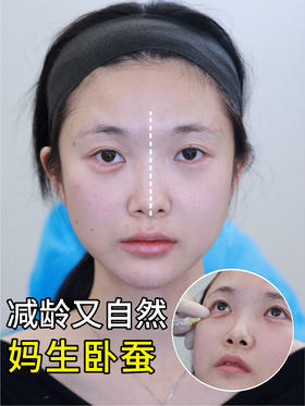 简单三步，get妈生卧蚕实现眼周年轻化❕