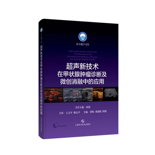 超声新技术在甲状腺肿瘤诊断及微创消融中的应用 商品图0