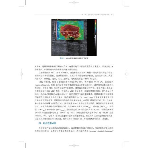 超声新技术在甲状腺肿瘤诊断及微创消融中的应用 商品图1