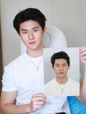 阔面肉肉脸微调，在广州do到了骨相脸！