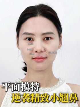 山根宽 + 鼻翼大？三步 get 精致小翘鼻！