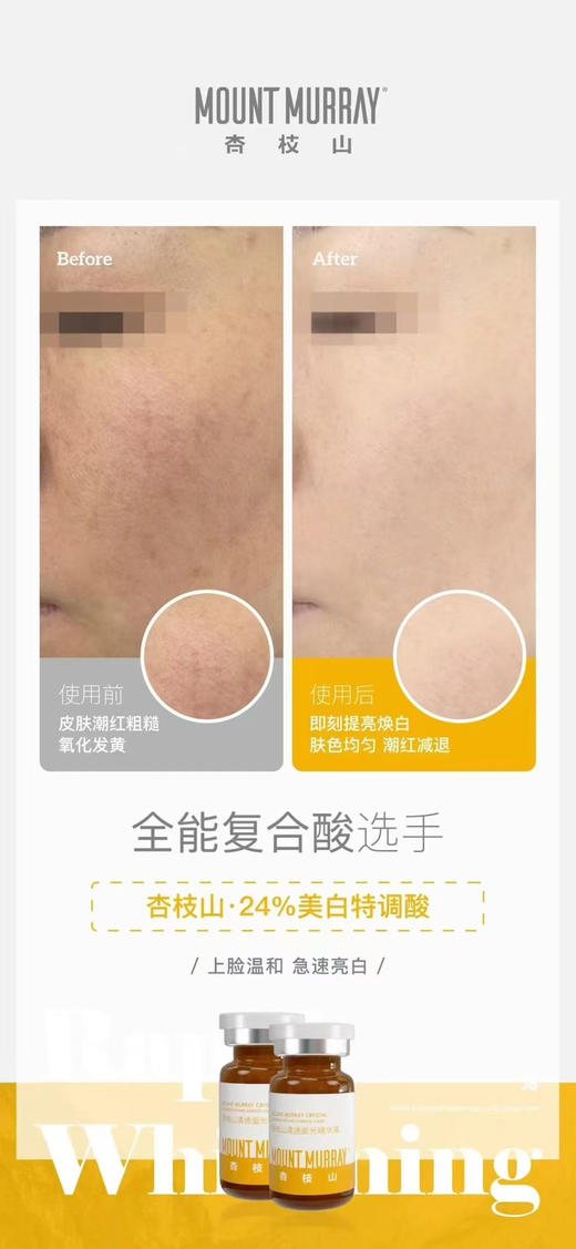 杏枝山24%美白特调酸配送刷酸工具5支/盒  清洁毛孔黑头闭口痘痘 商品图2