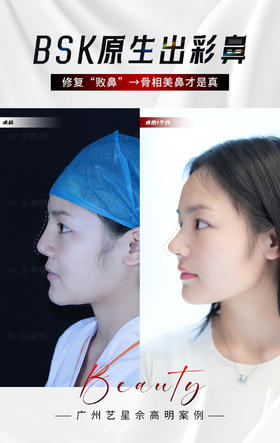 鼻子不是做的越高越好看🙅🏻‍♀️ 选对医生，好的审美才是关键💫 