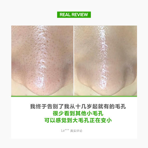 粗大毛孔救星！韩国Sungboon绿番茄毛孔紧致安瓶精华液40ml 收缩改善毛孔粗大精华  商品图7