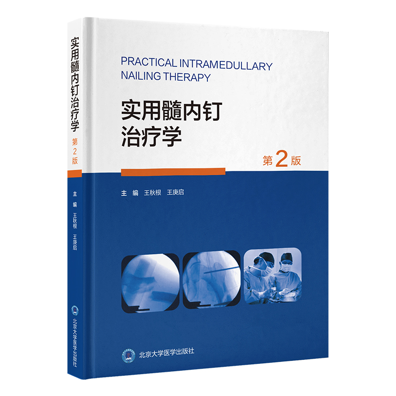 实用髓内钉治疗学（第2版）王秋根 王庚启 主编   北医社