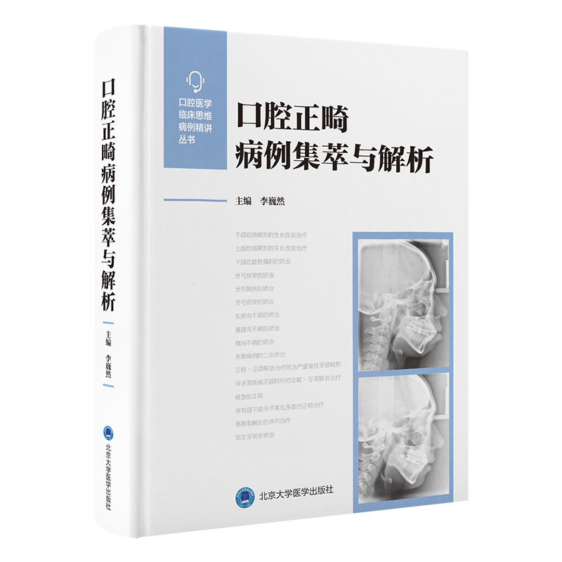 口腔正畸病例集萃与解析  李巍然 主编   北医社