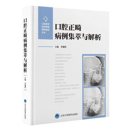 口腔正畸病例集萃与解析  李巍然 主编   北医社 商品图0