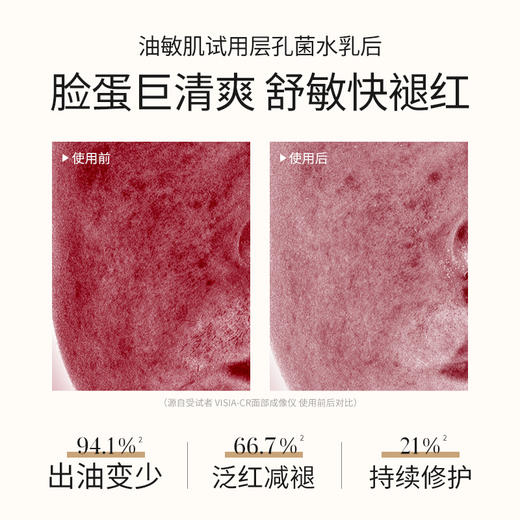 【油敏肌控油必选】溪木源层孔菌油敏肌控油水乳套装 商品图7