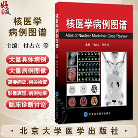 核医学病例图谱 付占立 何作祥 主编 本书通过典型病例与影像使您认识疾病并积累临床经验 9787565913402 北京大学医学出版社