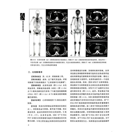 核医学病例图谱 付占立 何作祥 主编 本书通过典型病例与影像使您认识疾病并积累临床经验 9787565913402 北京大学医学出版社 商品图4