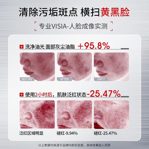 拥有“美白祛斑特证”！【JOSUR--洗卸护多合一美白洁面膏】氨基酸表活配方护肤 美白祛斑/控油保湿/舒缓修护/温和深净 7大功效深层清洁肌肤毛孔 让你越洗越白净！ 商品图7