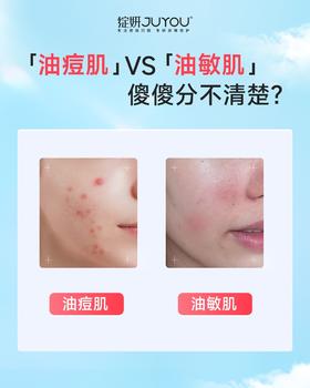 一分钟看懂“油痘肌”与“油敏肌”如何护理