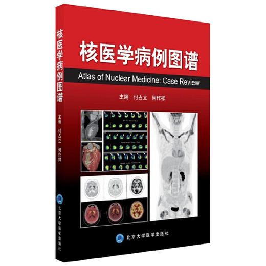 核医学病例图谱 付占立 何作祥 主编 本书通过典型病例与影像使您认识疾病并积累临床经验 9787565913402 北京大学医学出版社 商品图1