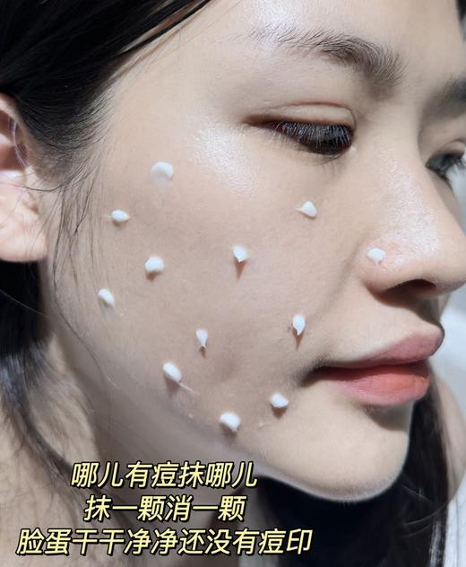 【泰国JXXINLIN·祛痘皮肤修护冷敷凝胶】祛痘救星，痘痘脸说拜拜~轻松搞定，温和不刺激 商品图2