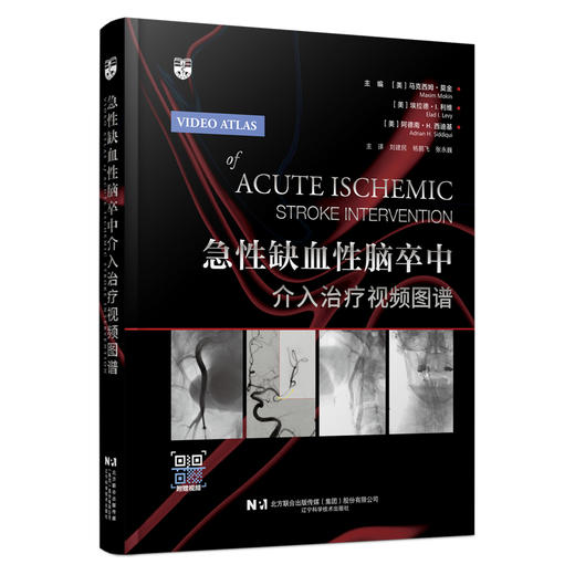 正版现货 急性缺血性脑卒中介入治疗视频图谱 商品图0