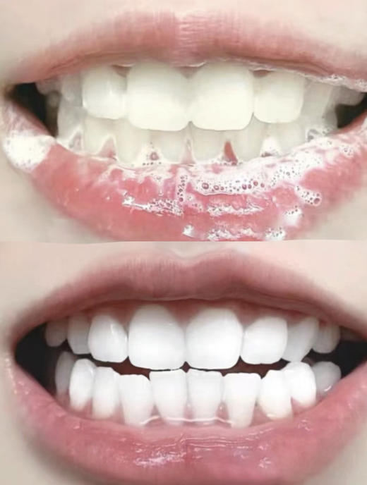 Chocoikes密柔牙刷山姆同售纤细软毛牙刷 商品图4