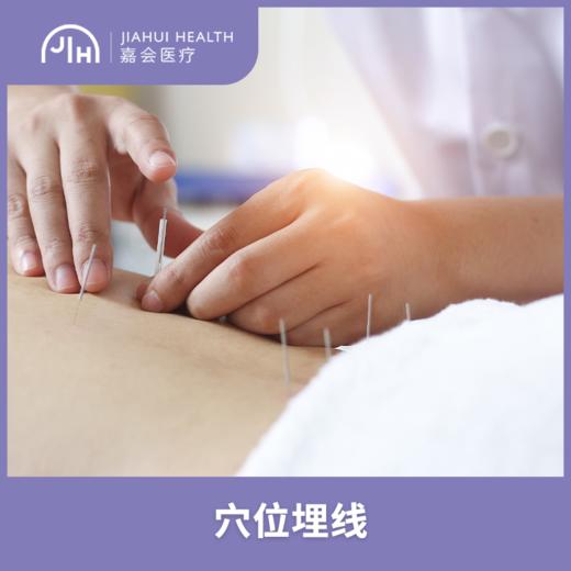 仅限苏州 身体穴位埋线 商品图0