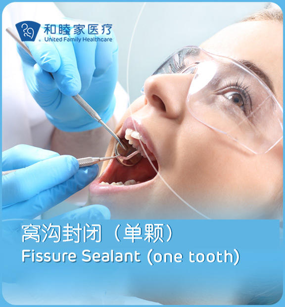 儿童窝沟封闭（单颗）