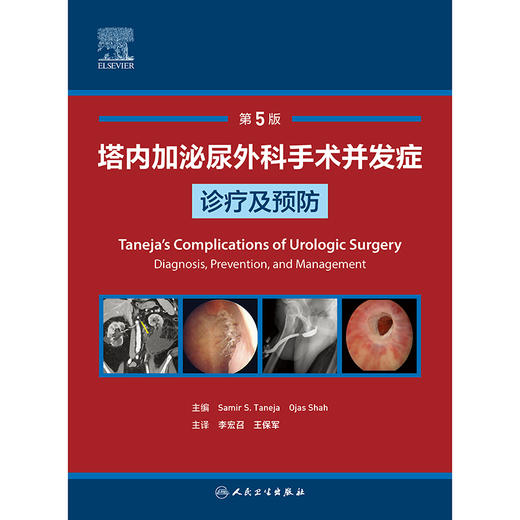 塔内加泌尿外科手术并发症诊疗及预防 商品图1
