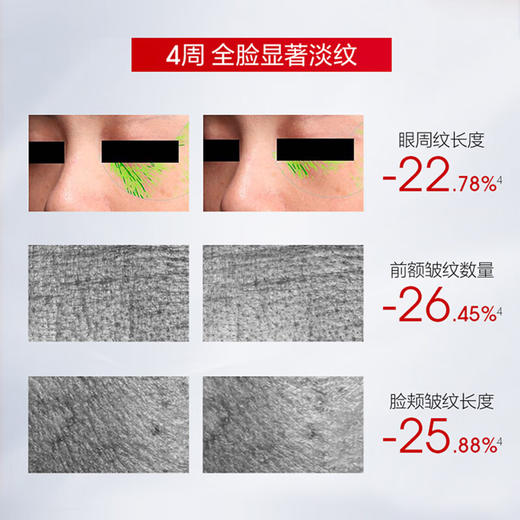 送红宝石面膜【自营】珀莱雅赋能鲜颜优效面膜(1.5ml+30ml)*5片装  （赠品红宝石面膜+红宝石水+乳+霜） 商品图3