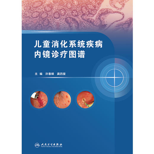儿童消化系统疾病内镜诊疗图谱 商品图1