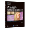 皮肤病学：视觉识别和病例分析（第2版）周城 主译   北医社 商品缩略图0