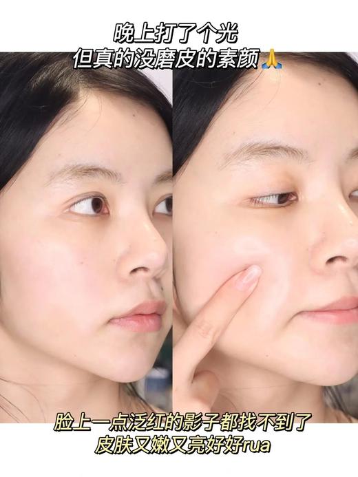 严选 |  华熙生物夸迪悬油次抛1.5ml*5支/盒 保湿抗老 抗氧舒缓 商品图6