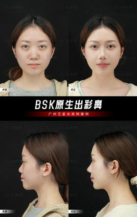 听劝做了个鼻👃🏻