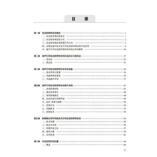 超声引导经皮肺穿刺活检图谱 王茵 徐辉雄 主编 一本聚焦于应用超声技术引导经皮肺活检的专著 9787117364669人民卫生出版社 商品图3
