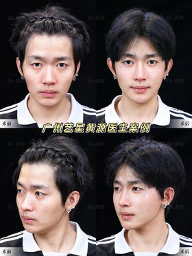 天呐，原来骨相微调真的会更帅~！！