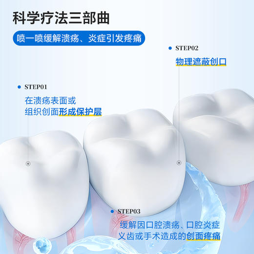 复因FOY 医用口腔溃疡含漱液 喷剂款50ml 可用于口腔溃疡 舌头起泡等 商品图4