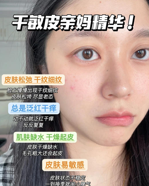 严选 |  华熙生物夸迪悬油次抛1.5ml*5支/盒 保湿抗老 抗氧舒缓 商品图5