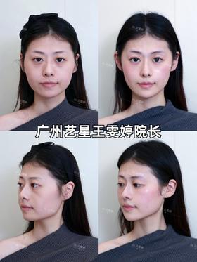 气质美改造计划【艺星王雯婷院长】