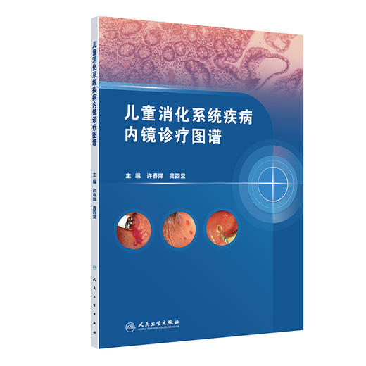 儿童消化系统疾病内镜诊疗图谱 许春娣 龚四堂 全面地阐述了儿科内镜在消化系统疾病中的应用和新进展9787117382120人民卫生出版社 商品图1
