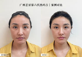 拒绝脸垮❗颜值回春易如反掌✌🏻