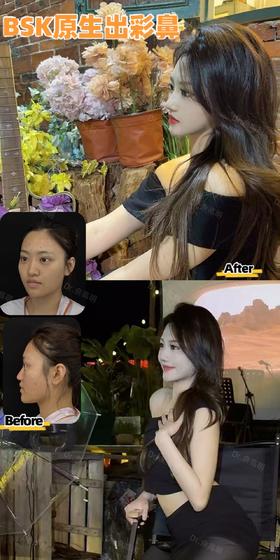 星粉术后好评返图【佘高明院长】