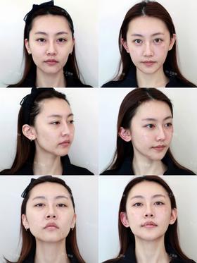 美力六宫格&【星粉王艺霖】