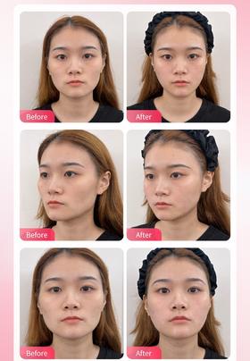 气质微整&原生美学