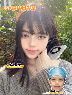 星粉返图BSK原生出彩鼻【佘高明院长】