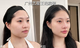 给微整一点小小的震感