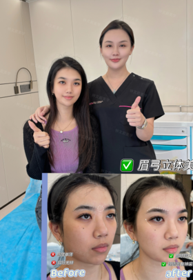 眉弓立体美【钟文君】