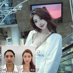 轮廓固定【王艳院长】