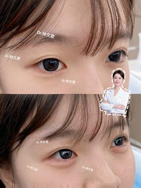 卧蚕打造【钟文君主任】