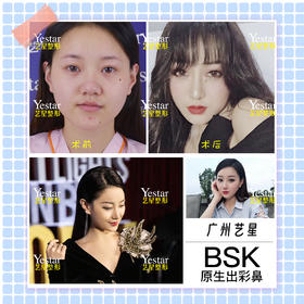 高人气网红术后好评返图