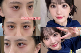 明星同款卧蚕【钟文君主任】