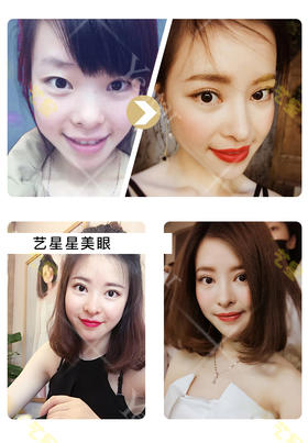 星粉术后晒图【曾繁茂院长】