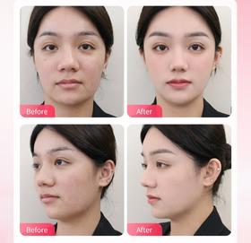 气质微整&防馒化美学