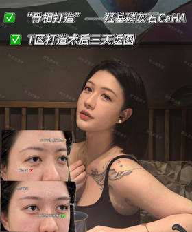 骨相打造【钟文君主任】