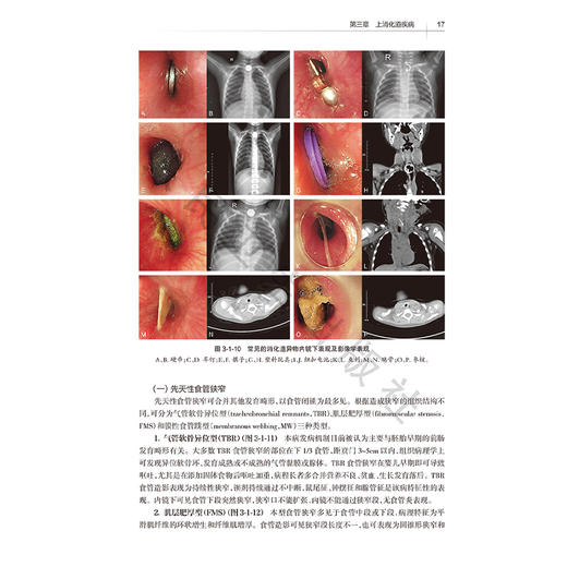 儿童消化系统疾病内镜诊疗图谱 许春娣 龚四堂 全面地阐述了儿科内镜在消化系统疾病中的应用和新进展9787117382120人民卫生出版社 商品图4